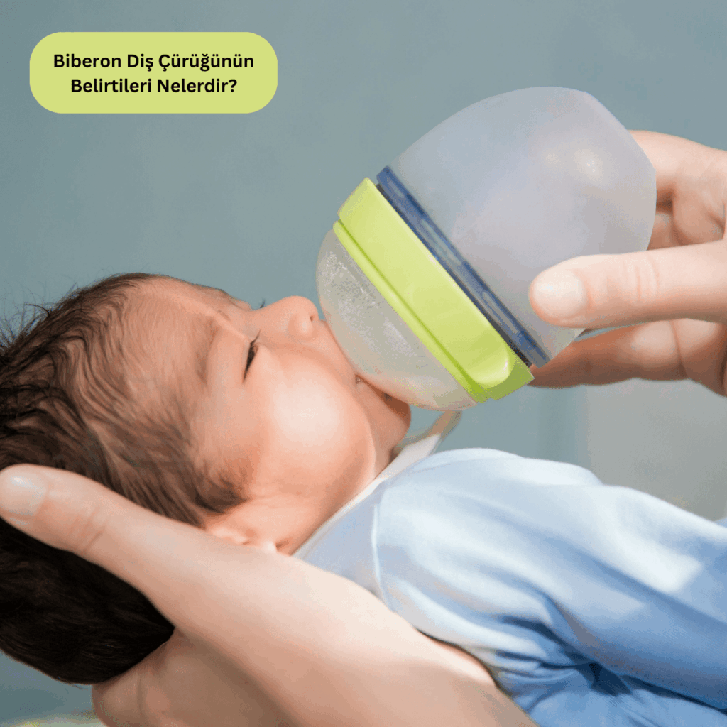 Biberon Diş Çürüğünün Belirtileri Nelerdir