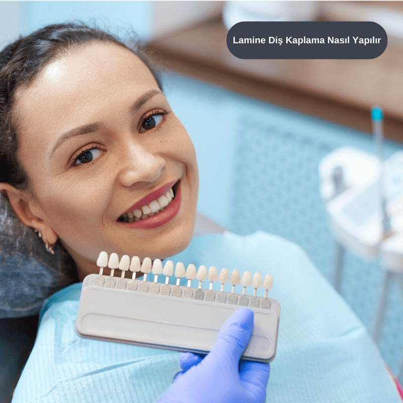 Lamine Diş Kaplama Nasıl Yapılır