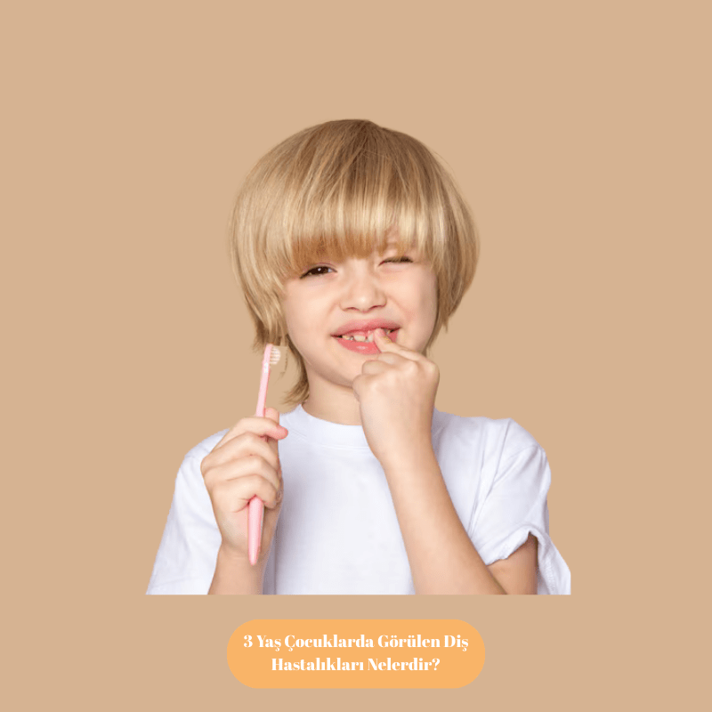 3 Yaş Çocuklarda Görülen Diş Hastalıkları Nelerdir