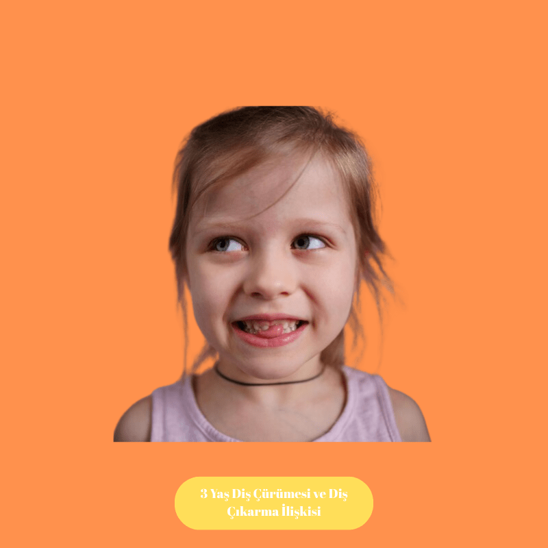 3 Yaş Diş Çürümesi ve Diş Çıkarma İlişkisi
