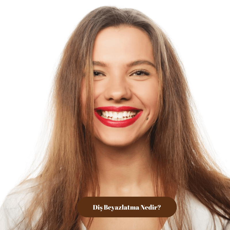 Diş Beyazlatma Nedir