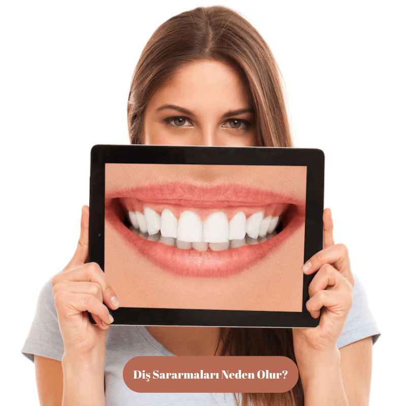 Diş Beyazlatma Yöntemleri Nedir