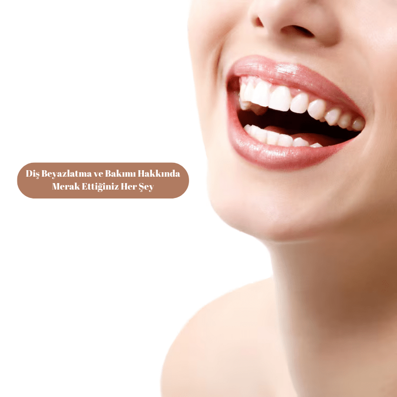 Diş Beyazlatma ve Bakımı Hakkında Merak Ettiğiniz Her Şey