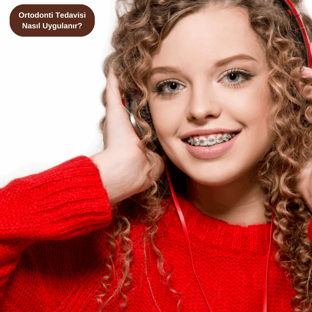 Ortodonti Tedavisi Nasıl Uygulanır