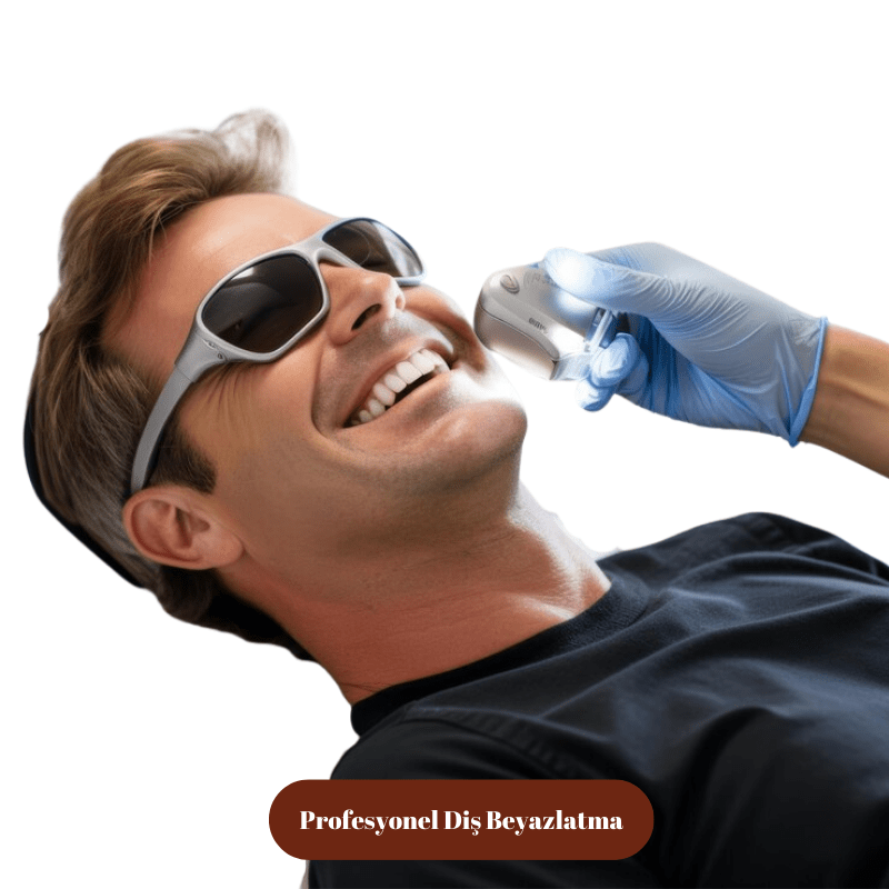 Profesyonel Diş Beyazlatma